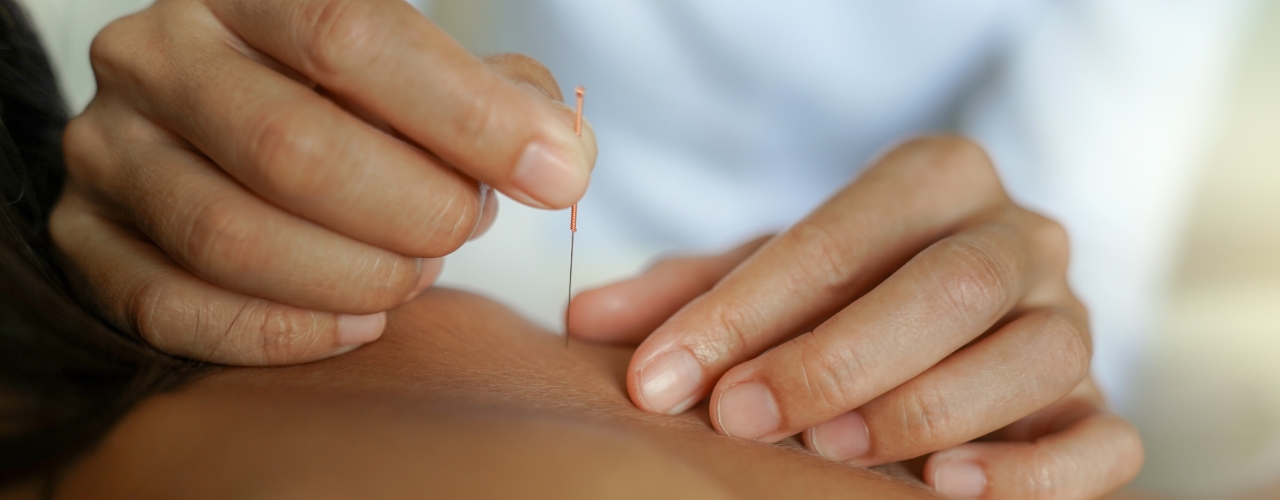 dry-needling-elements-physiotherapy-and-rehabilitation-Oshawa-ON