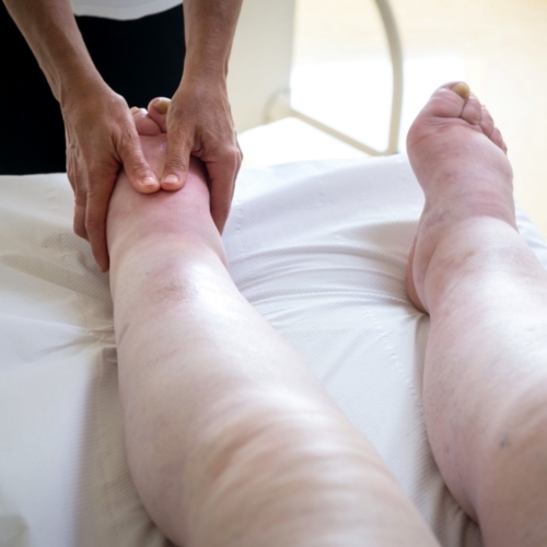 lymphedema-Elements-Physiotherapy-and-Rehabilitation-North-Oshawa-ON